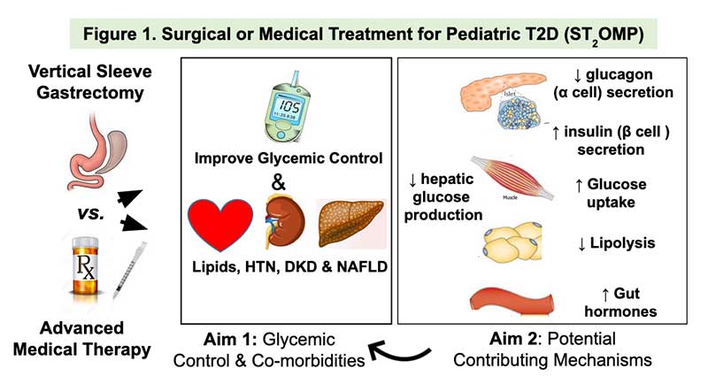 Surgical or Medical Treatment for Pediatric Type 2 Diabetes